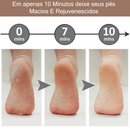 NOVO - Lixador de Pé Elétrico - Esfoliador Tira Calos Pedicure Portátil
